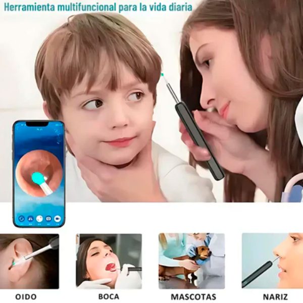 VIDEOLIMPIADOR DE OIDOS OTOCLEAN 360 + ENVIO GRATIS